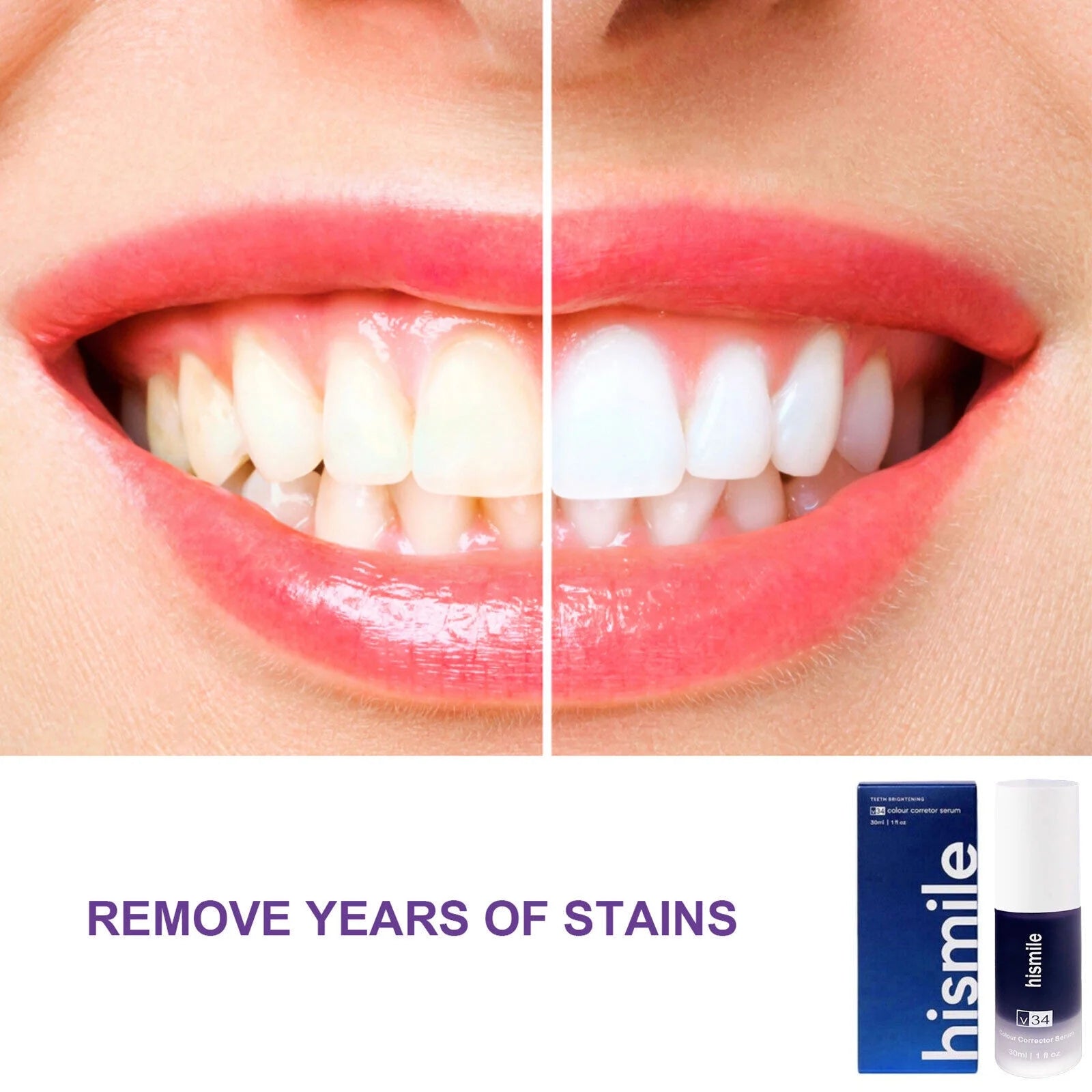 V34 Teeth Whitening Serum (Free Home Delivery)