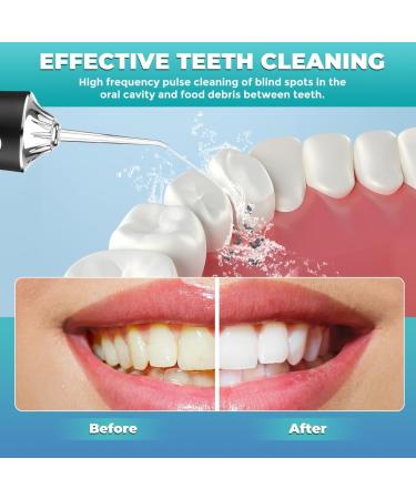 Rechargeable Portable Water Flosser  (Free Home Delivery)