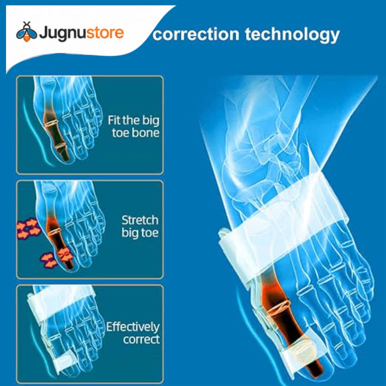 (Free Home Delivery) Pain Relief Bunion Toe Corrector