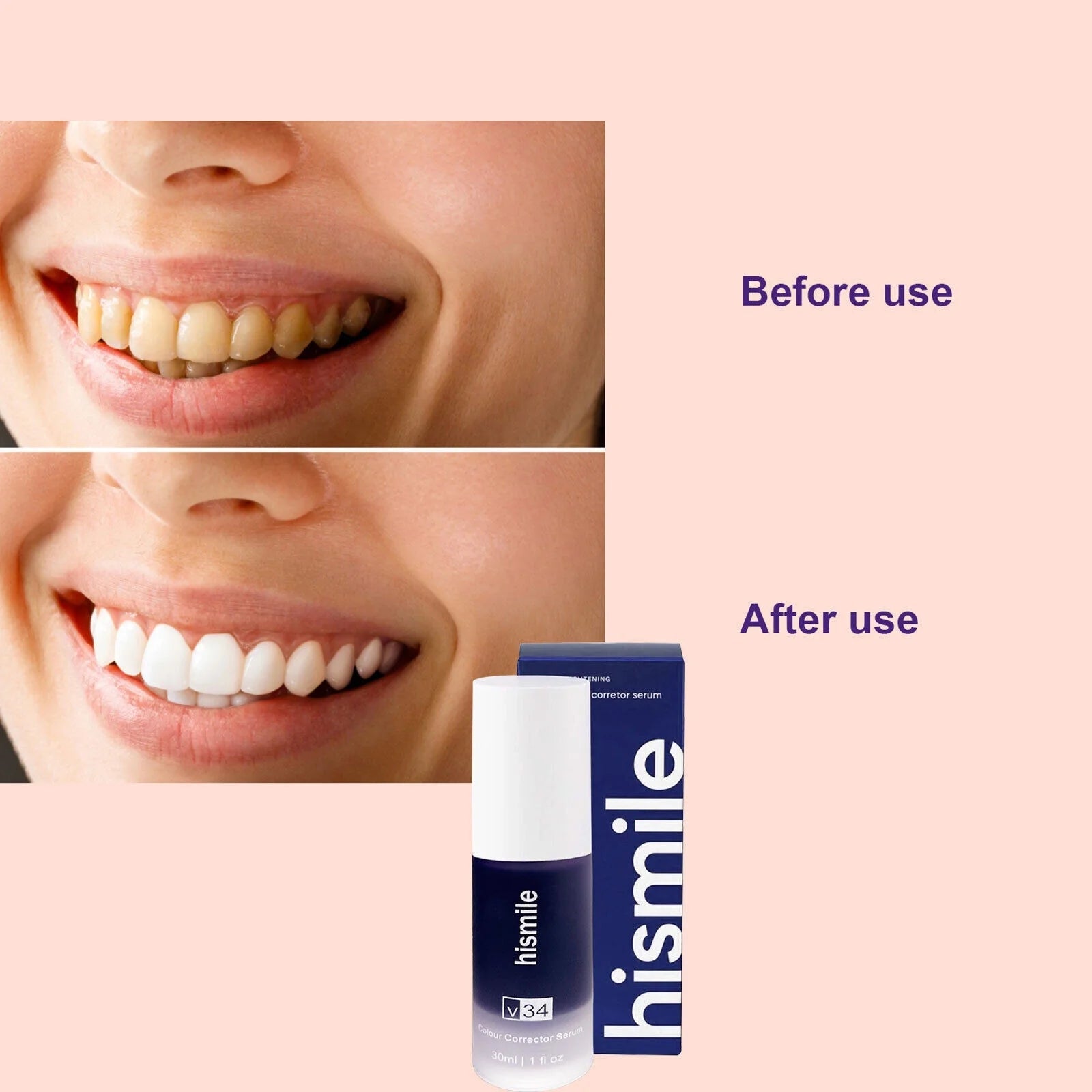 V34 Teeth Whitening Serum (Free Home Delivery)
